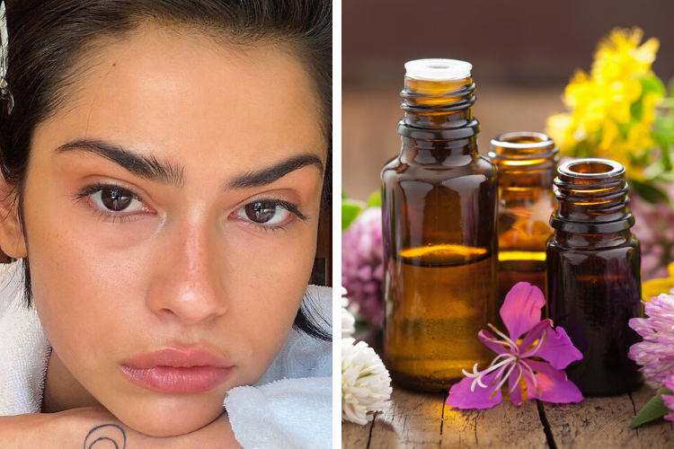 Quelles solutions naturelles pour traiter les microkystes ?