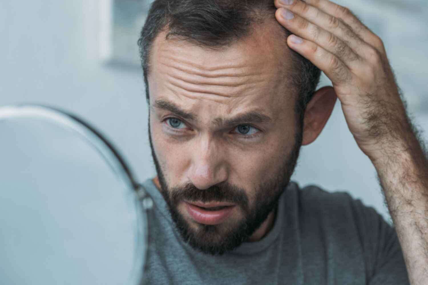 Chute de cheveux : comprendre et freiner son alopécie