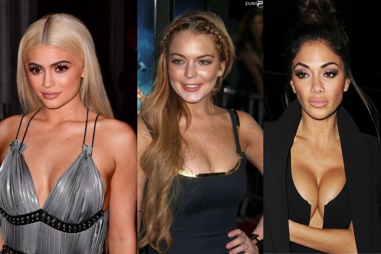 Avant/après : la chirurgie esthétique et les stars