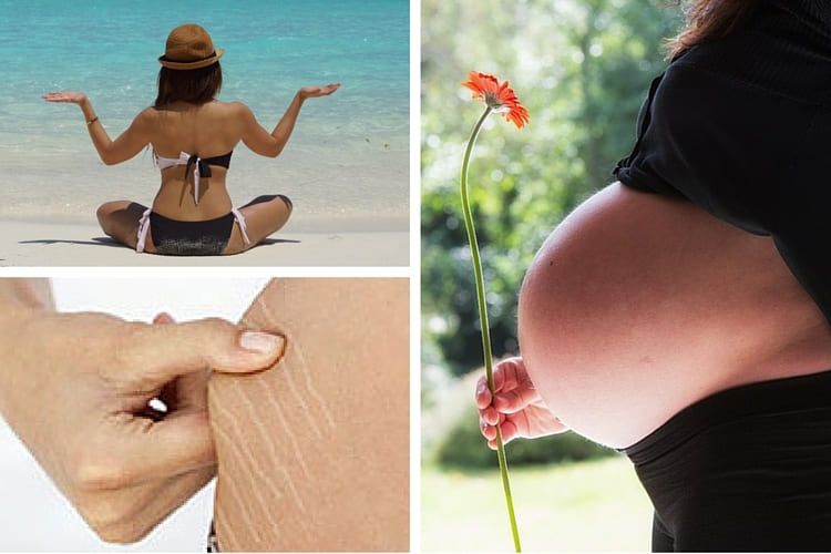 Les meilleurs produits pour atténuer les vergetures