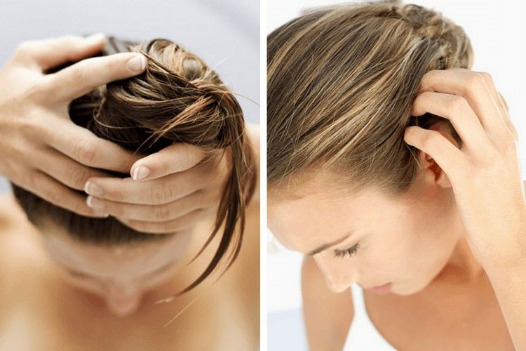 Prendre soin de son cuir chevelu pour avoir de beaux cheveux