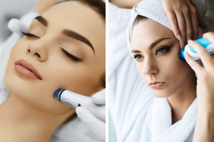 Peeling dermatologique pour prendre soin de sa peau