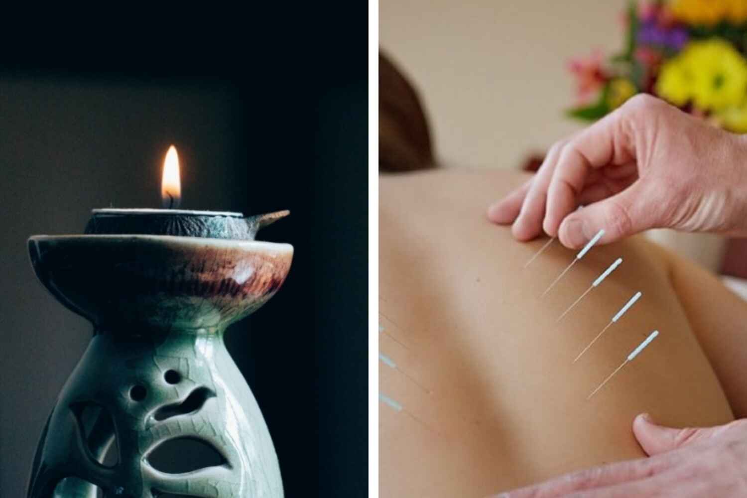Points d'acupuncture pour le visage et le corps