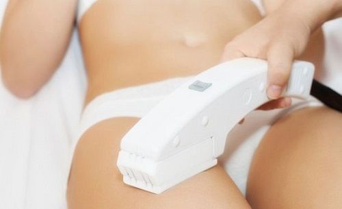 L'épilation au laser : une solution efficace et durable !