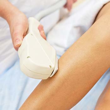 l'épilation laser est-elle efficace ? 