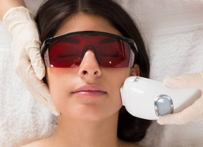 Un traitement au laser pour enlever les cicatrices
